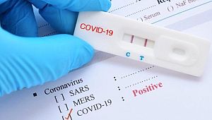 Şanlıurfa'da 1 mahalle ile 10 bina karantinaya alındı